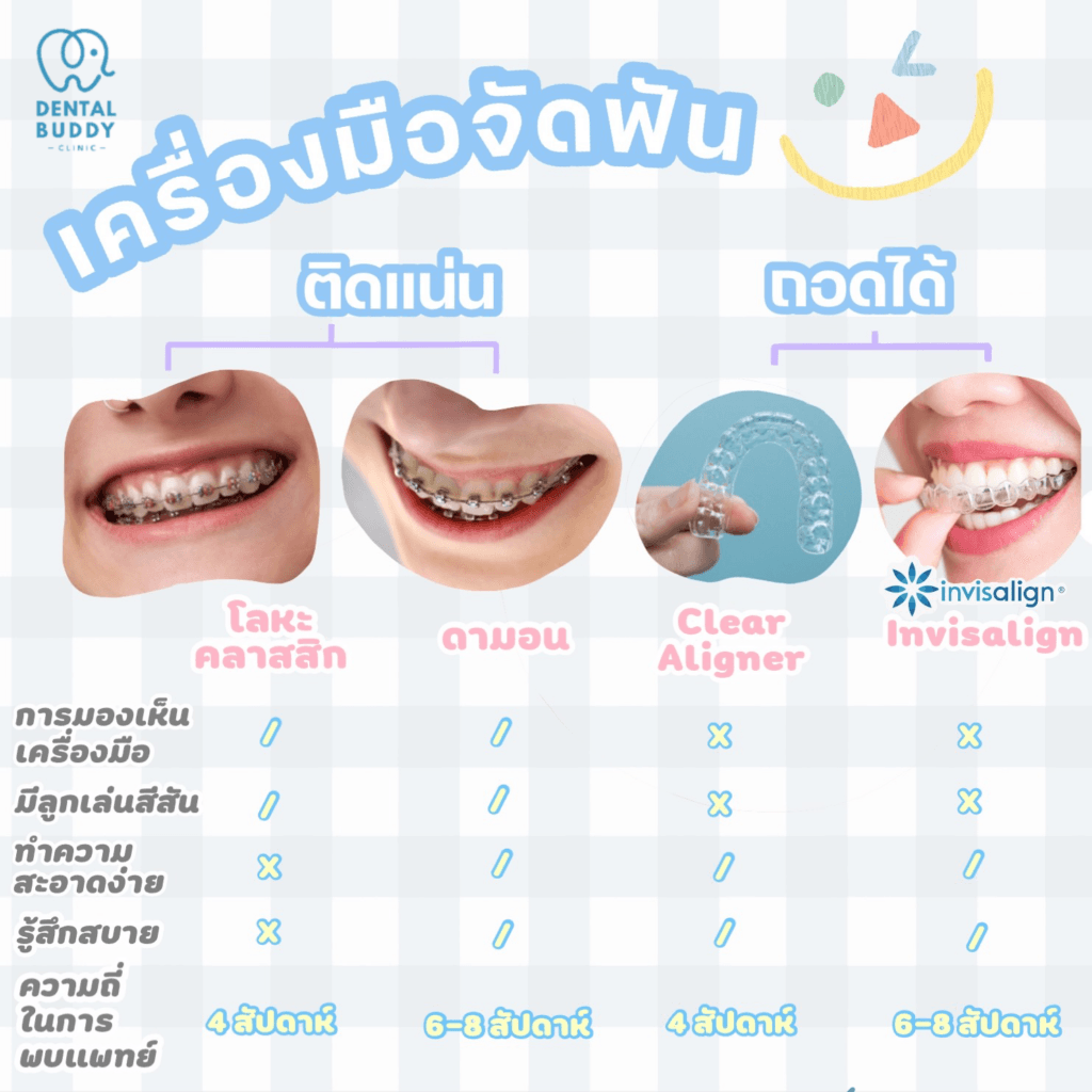 ตารางเปรียบเทียบ จัดฟันแต่ละแบบ