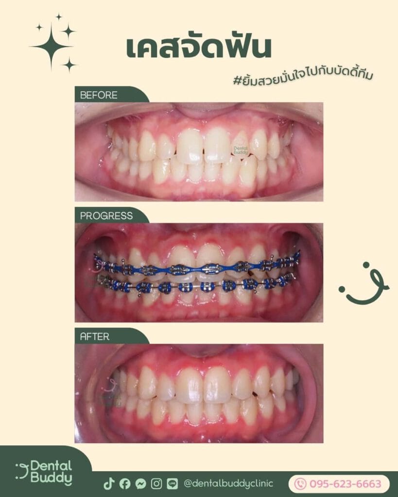 6522-36953 02 Front 3p