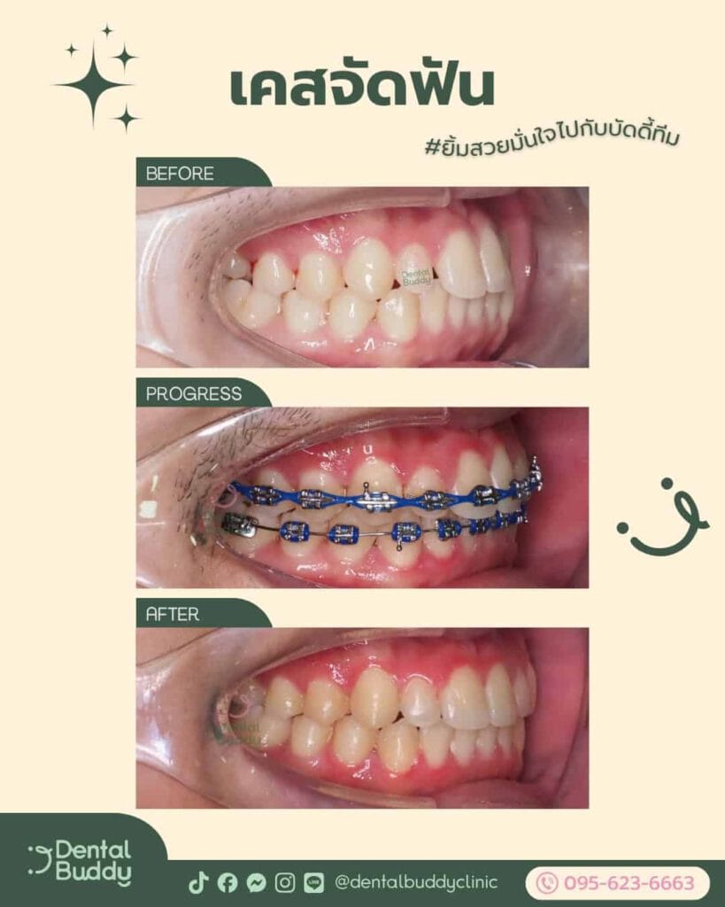 6522-36953 03 Left 3p