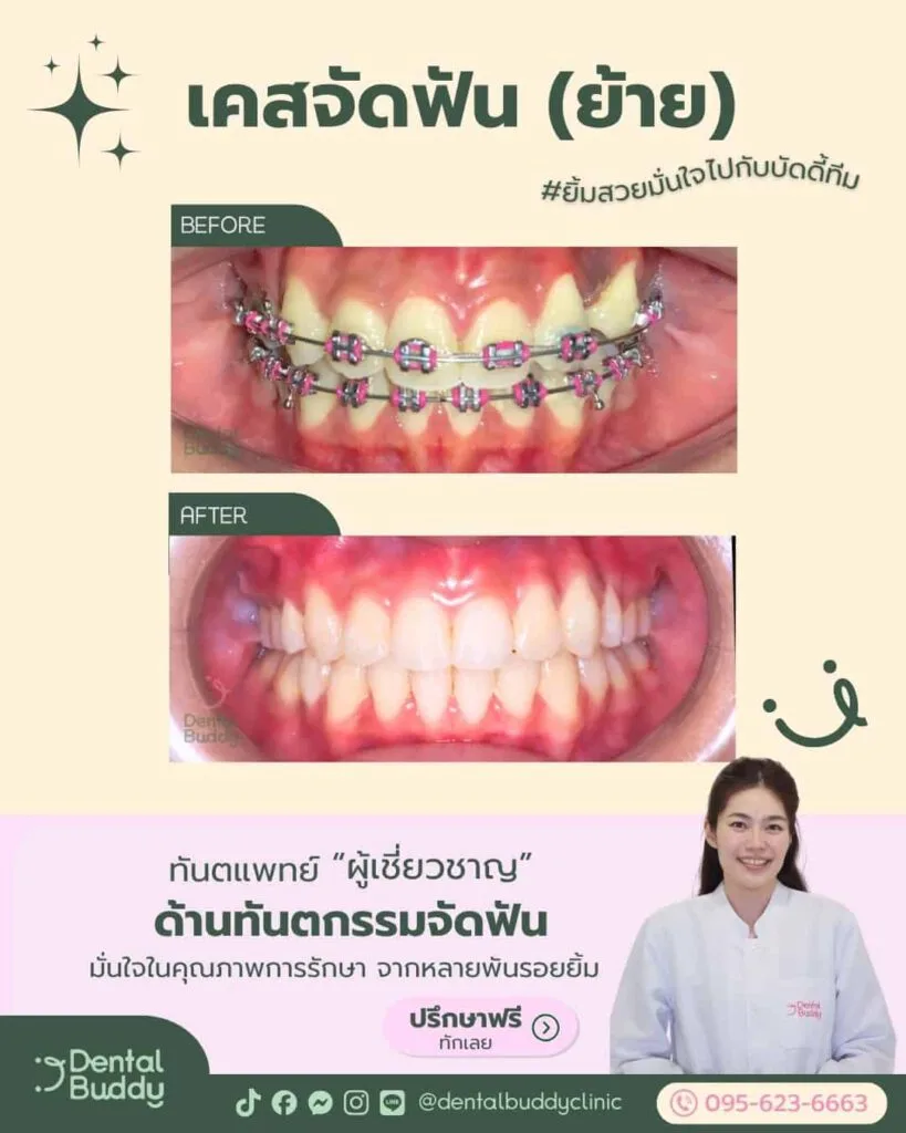 6522-06352 01.1 Main