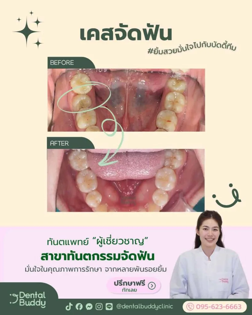 6522-06756 01.0 Main