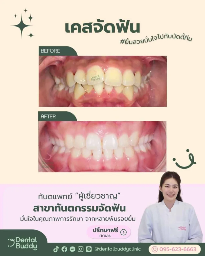 6522-06756 01.1 Main