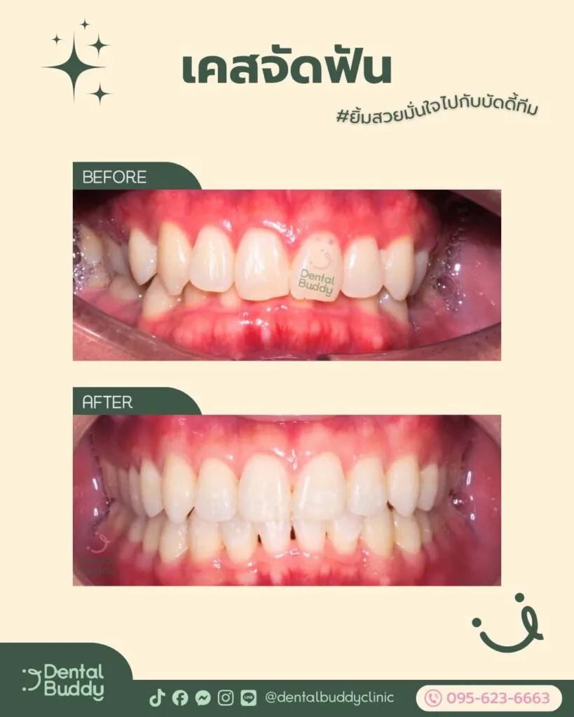 6522-16550 02 Front 2p