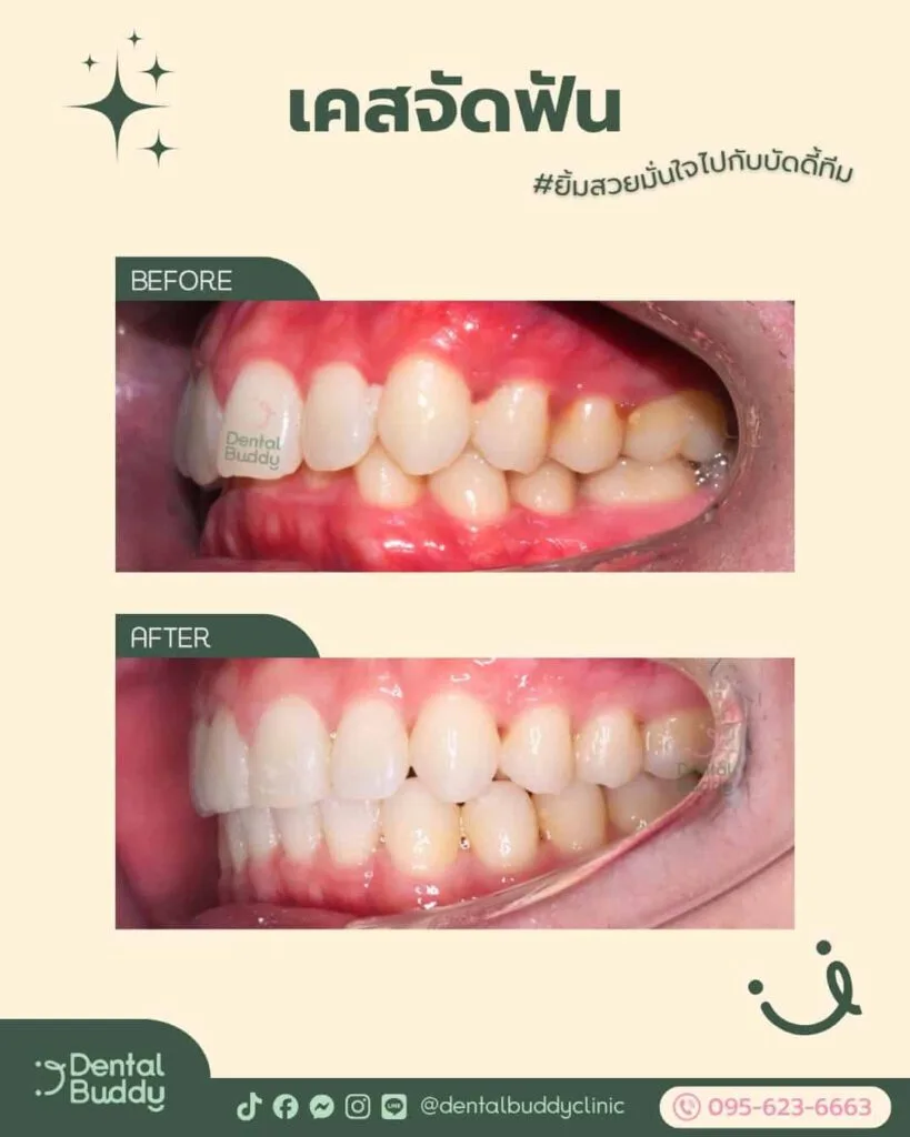 6522-16550 03 Left 2p