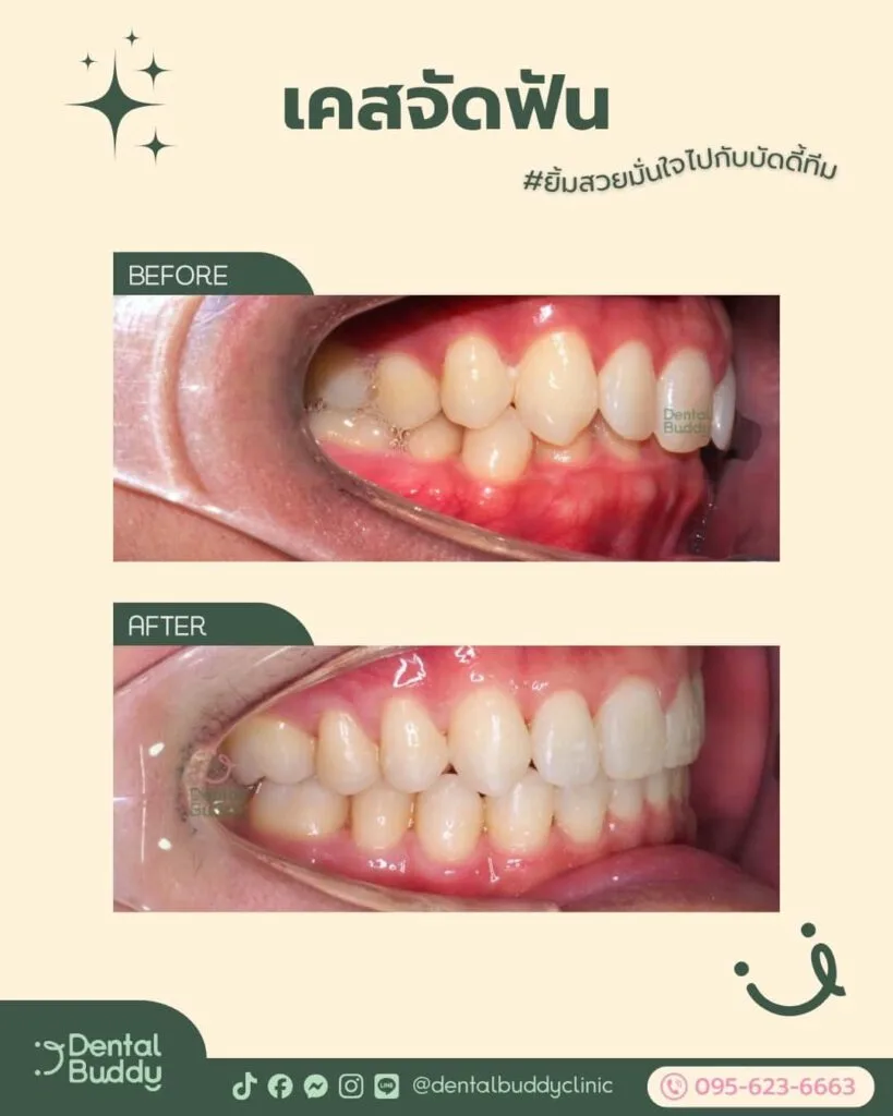 6522-16550 04 Right 2p