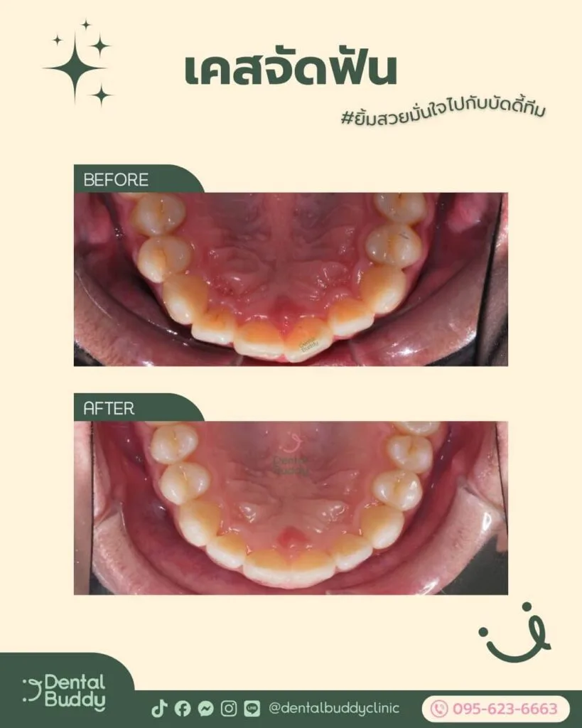 6522-16550 06 Lower 2p