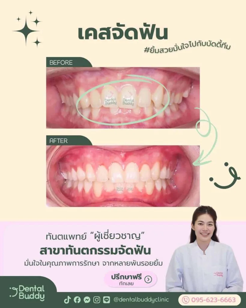 6522-46059 01 Main Photo