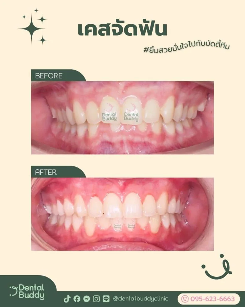 6522-46059 02 Front 2p