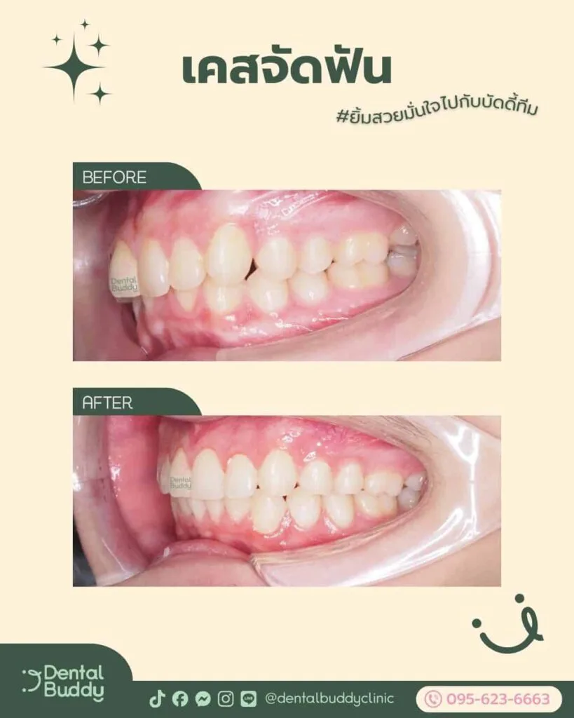 6522-46059 03 Left 2p