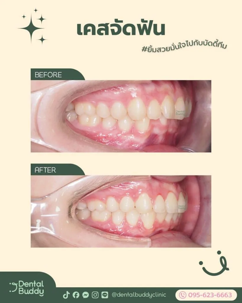 6522-46059 04 Right 2p