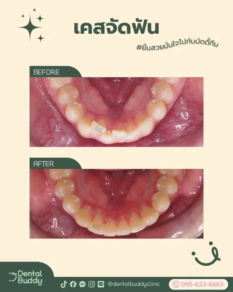 6522-46059 06 Lower 2p