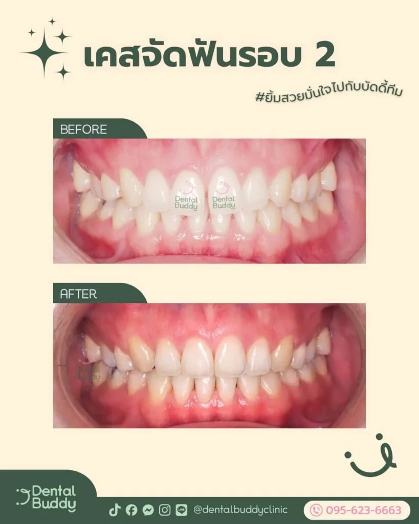 6522-56859 02.1 Front 2p