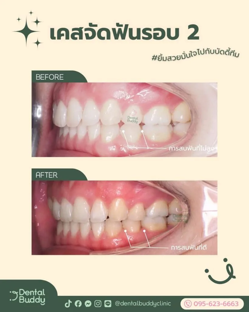 6522-56859 03 Left 2p