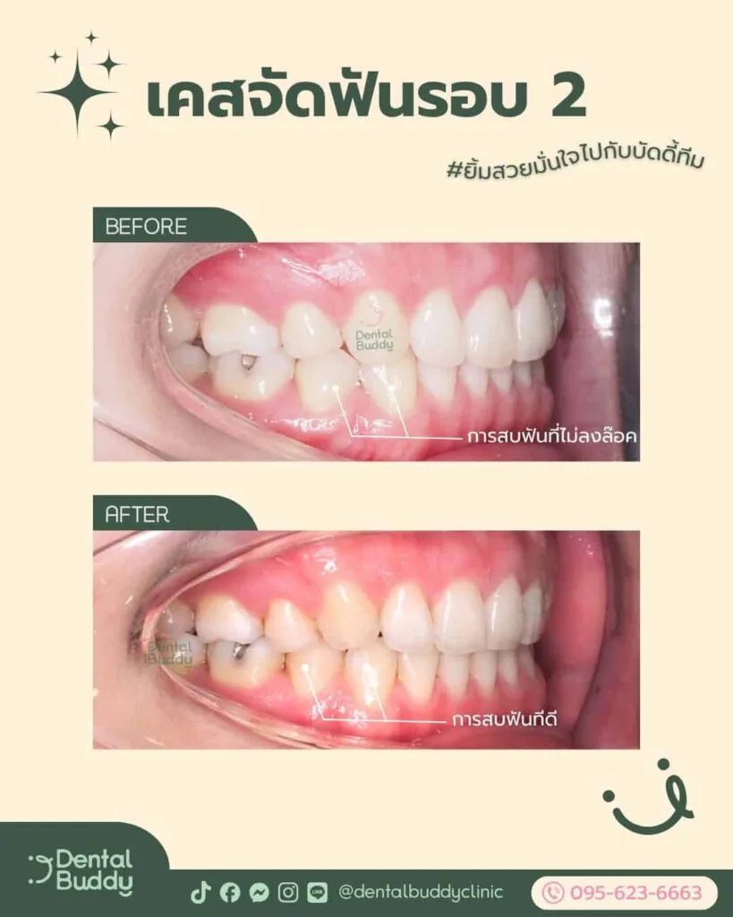 6522-56859 04 Right 2p